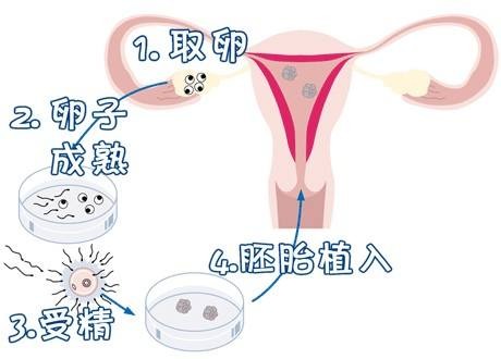 时差成像